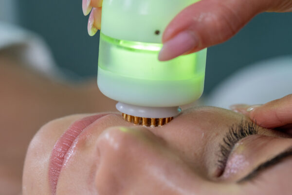 Trattamento-Laser-a-baso-livello-VISO